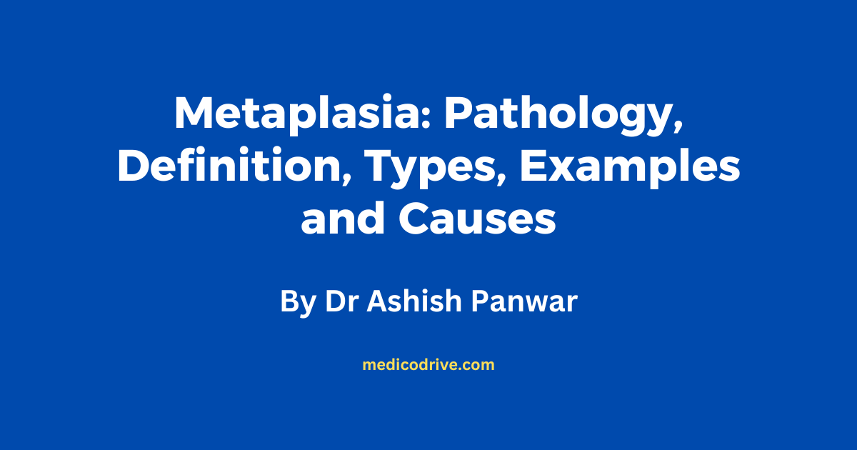 Metaplasia: Pathology, Definition, Types, Causes and Examples