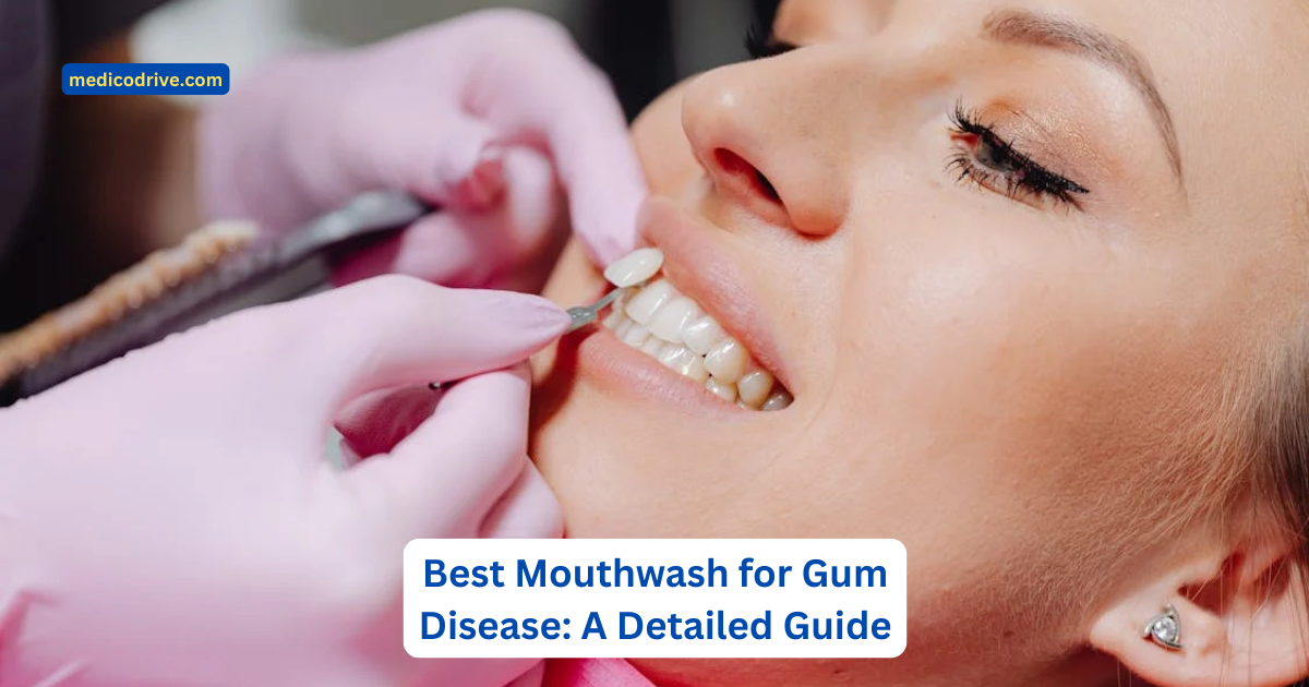 Best Mouthwash for Gum Disease: A Detailed Guide 1 Best Mouthwash for Gum Disease