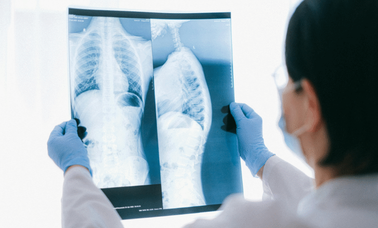 India’s Major Win Against TB: 21% Decline in Cases, Says WHO Report | Medicodrive